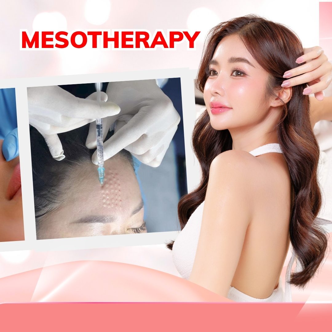 Mesotherapy – Liệu Pháp Tiêm Dưỡng Chất Trung Bì Giúp Phục Hồi Và Trẻ Hóa Da Toàn Diện